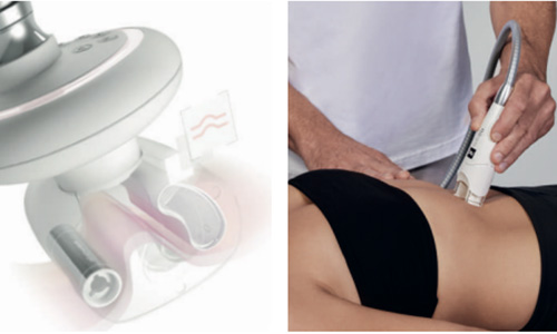 lpg_preg_0000_lpg - 12121