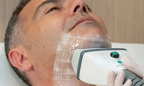 double-chin-removal_tech_0000_Layer 2