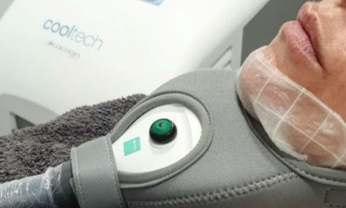 double-chin-removal_tech_0001_Layer 1