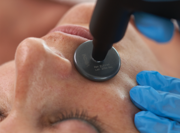 Indiba Double Chin Treatment 12