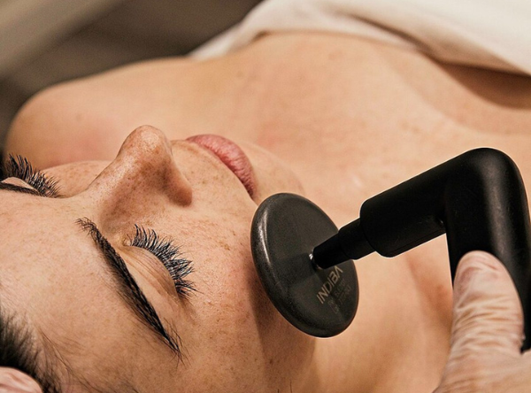 Indiba Double Chin Treatment 13