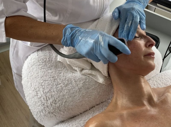 Indiba Double Chin Treatment 14