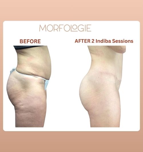 morfologie before after image (10)