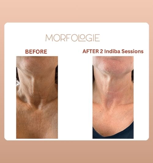 morfologie before after image (11)