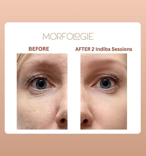 morfologie before after image (13)