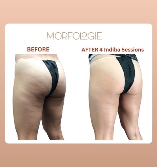 morfologie before after image (14)