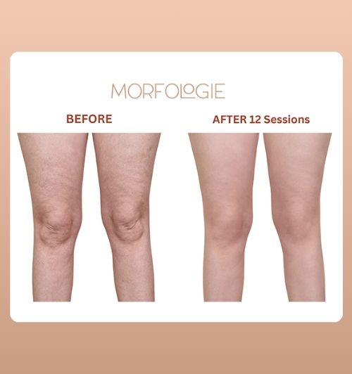 morfologie before after image (15)