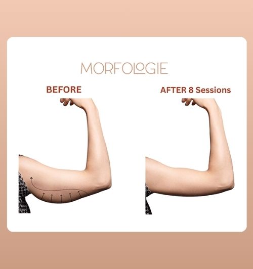 morfologie before after image (16)