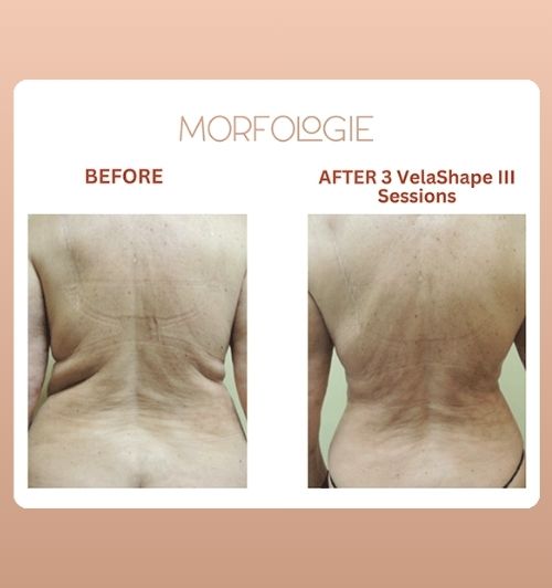 morfologie before after image (17)