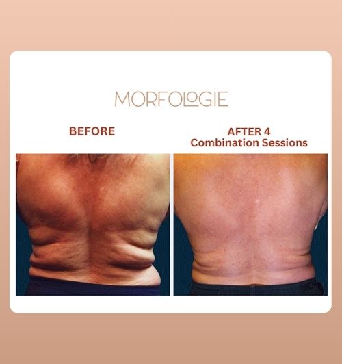 morfologie before after image (18)