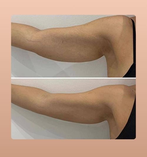 morfologie before after image (19)