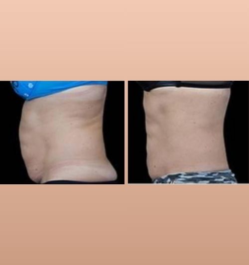 morfologie before after image (2)