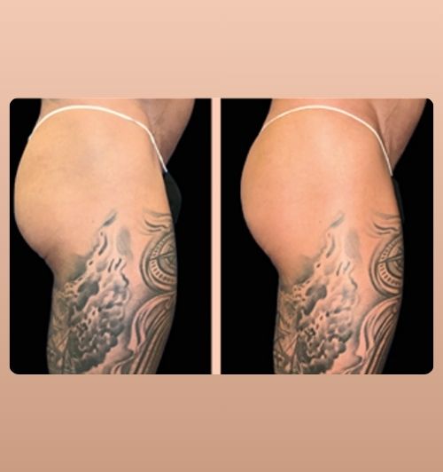 morfologie before after image (20)