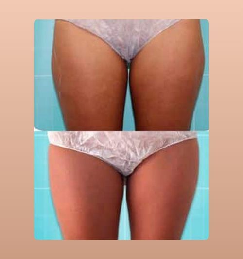 morfologie before after image (21)