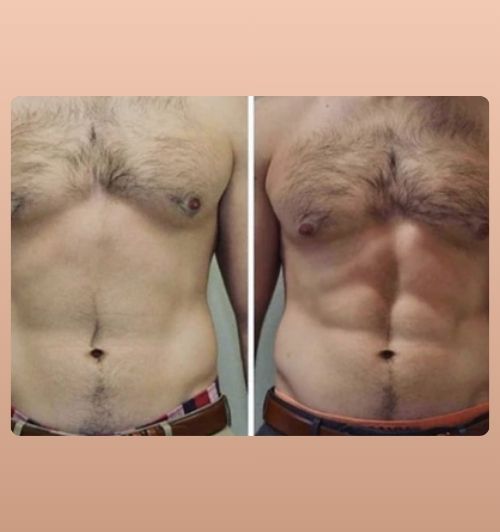 morfologie before after image (22)