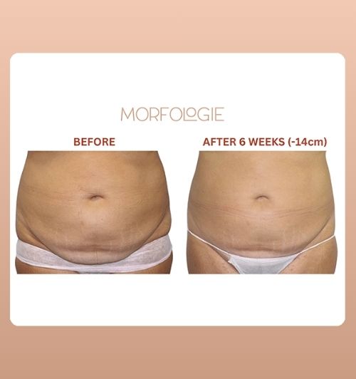 morfologie before after image (23)