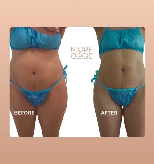 morfologie before after image (24)