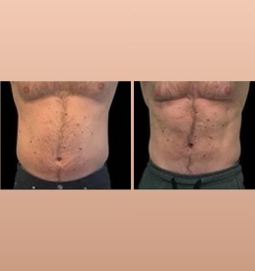 morfologie before after image (3)