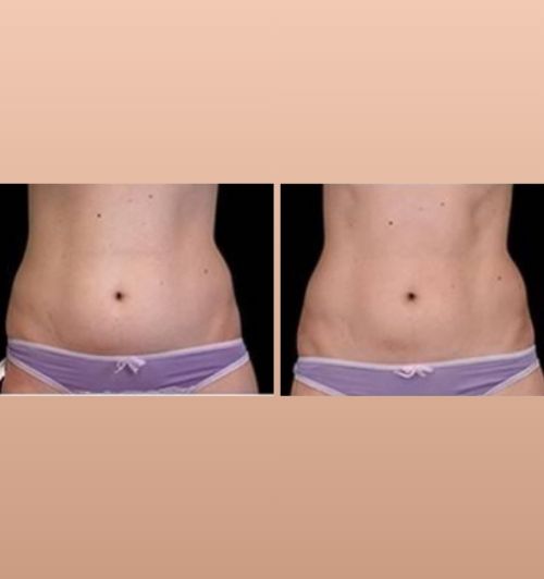 morfologie before after image (4)