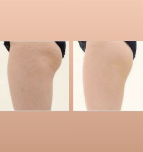 morfologie before after image (6)