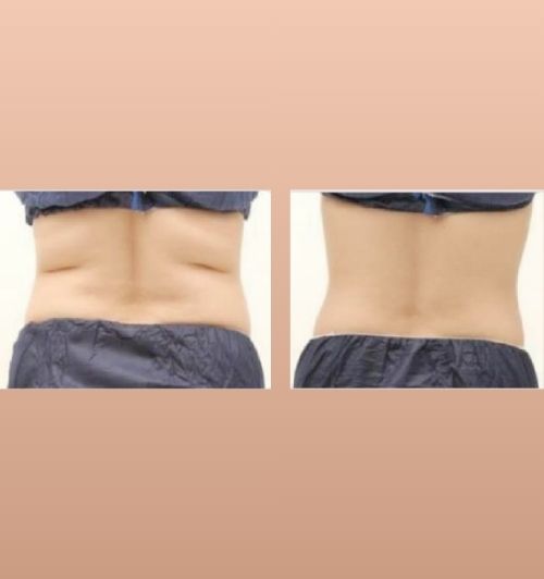 morfologie before after image (7)