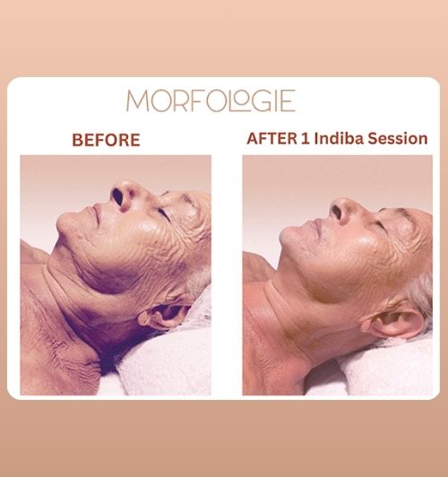 morfologie before after image (8)