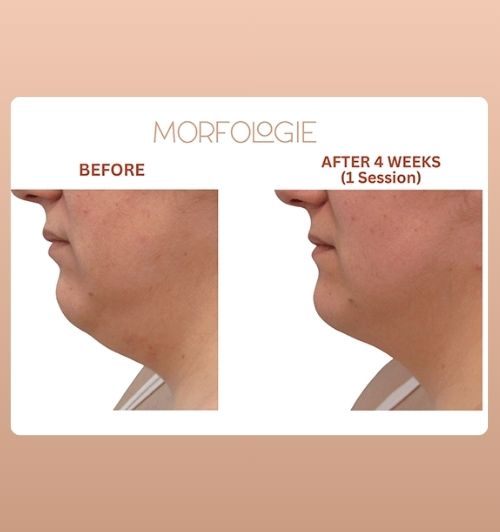 morfologie before after image (9)