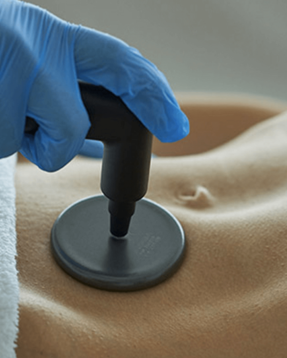 indiba technology in action (3)